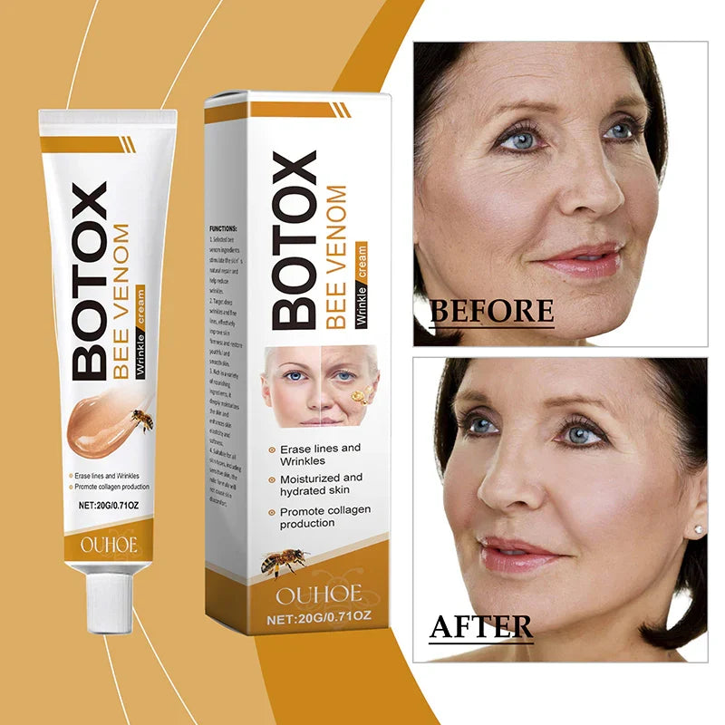 Botox Bee Venom Wrinkle Removal Cream